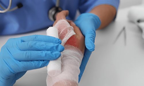 wound care